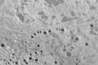 Científicos argentinos hallan una nueva forma de frenar el crecimiento de tumores intracraneales