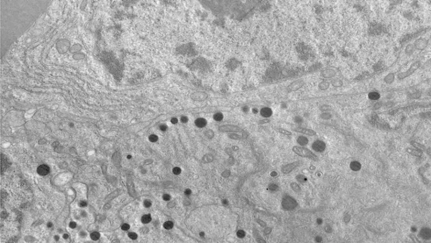 Científicos argentinos hallan una nueva forma de frenar el crecimiento de tumores intracraneales