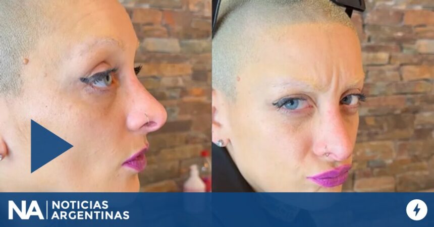 La complicación que padece Furia tras haberse sometido a una cirugía de nariz