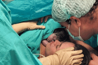 El Garrahan hizo historia: primer hospital público de Argentina en realizar una cirugía a una bebé dentro del útero de su madre