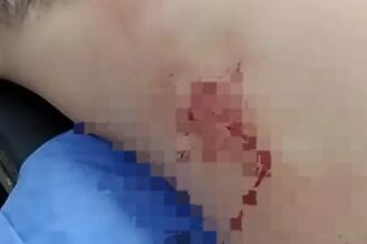 SÁENZ PEÑA: Estaba Bebiendo Con Amigos Cuando Fue Apuñalado Por Otro Hombre