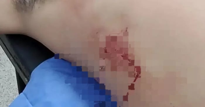 SÁENZ PEÑA: Estaba Bebiendo Con Amigos Cuando Fue Apuñalado Por Otro Hombre