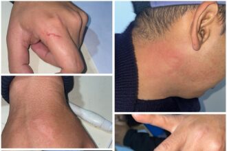 CIERVO PETISO: Tras Un Desorden Detuvieron A Varios Sujetos