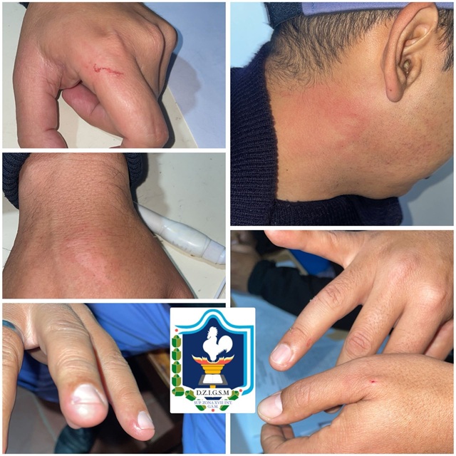 CIERVO PETISO: Tras Un Desorden Detuvieron A Varios Sujetos