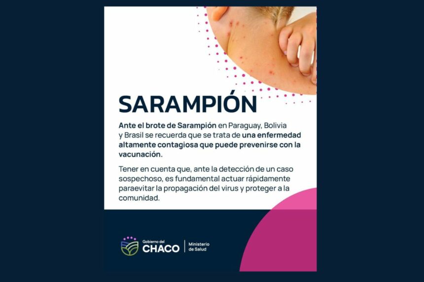 Chaco Libre De Sarampión: Salud Reforzó La Vigilancia Y Llamó A Completar Vacunas