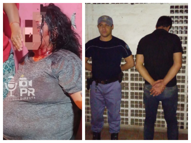 CONCEPCION DEL BERMEJO: Detenido Por Golpear Brutalmente A Su Ex Pareja Embarazada