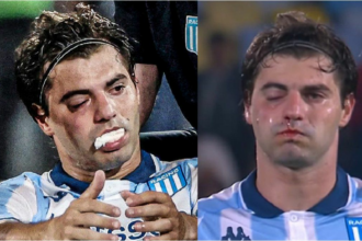 Preocupación en Racing: Santiago Sosa tiene fractura de maxilar por el golpe de Marcos Rojo y es duda para la revancha ante Flamengo