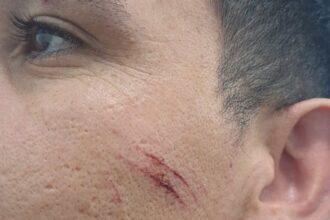 CHARATA: Detienen A Un Joven Que Lesionó A Un Policía Durante Un Control