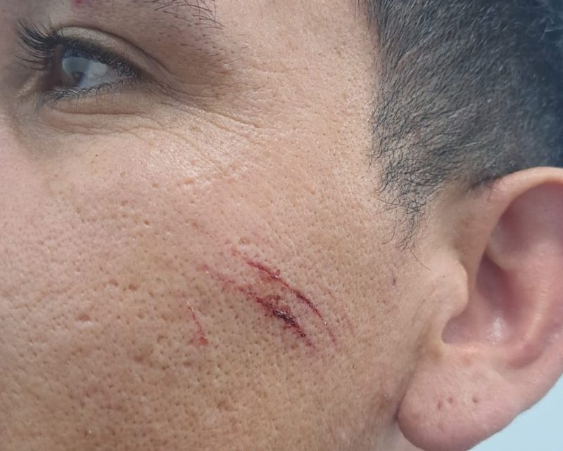 CHARATA: Detienen A Un Joven Que Lesionó A Un Policía Durante Un Control