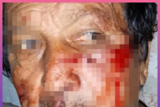 SAENZ PEÑA: Brutal Ataque A Un Jubilado Lo Golpearon Con Un Ladrillo En Pleno Robo