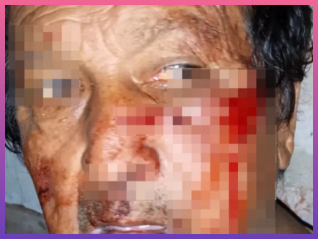 SAENZ PEÑA: Brutal Ataque A Un Jubilado Lo Golpearon Con Un Ladrillo En Pleno Robo