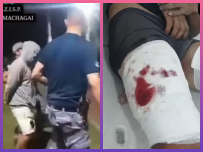 MACHAGAI: Detuvieron A Un Joven Acusado De Herir A Un Vecino Con Una Escopeta
