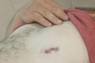 FONTANA: Un Policía Intentó Evitar un Robo y fue Baleado Frente a su Domicilio.