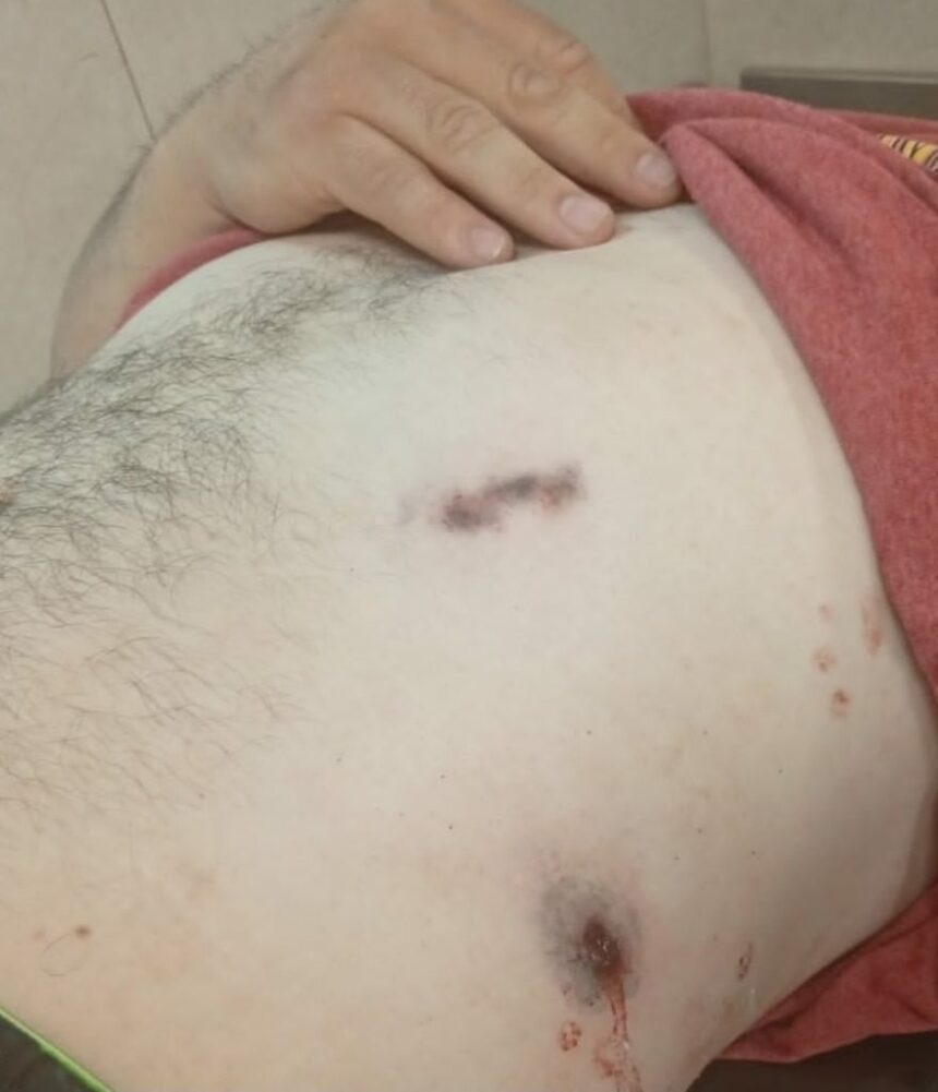 FONTANA: Un Policía Intentó Evitar un Robo y fue Baleado Frente a su Domicilio.