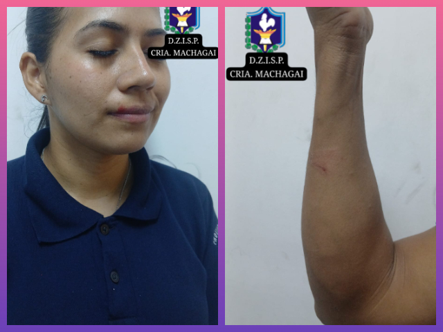 MACHAGAI: Detuvieron A Un Sujeto Por Supuestas Lesiones, Resistencia Y Atentado Contra La Autoridad