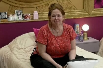 Andrea del Boca mostró su cara tras su accidente en Gran Hermano