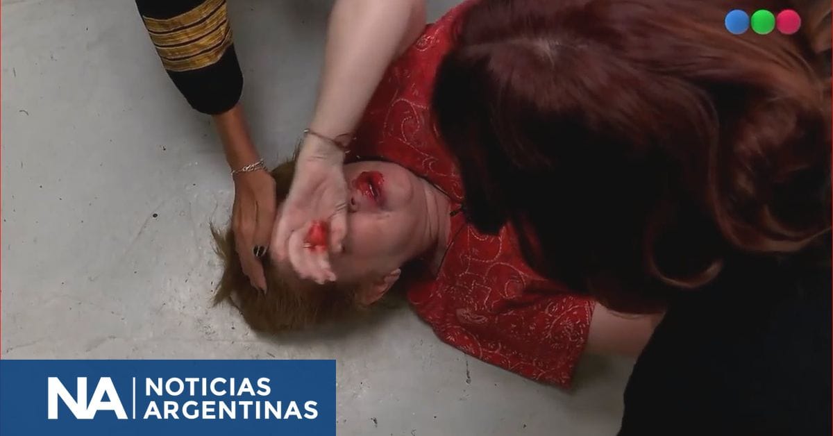 Difunden la imagen de Andrea del Boca ensangrentada: polémico momento en Gran Hermano Difunden la imagen de Andrea del Boca ensangrentada: polémico momento en Gran Hermano